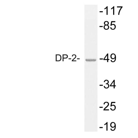 Western Blot - Anti-DP-2 Antibody (R12-2118) - Antibodies.com