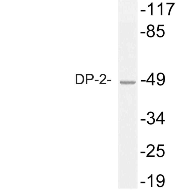 Western Blot - Anti-DP-2 Antibody (R12-2118) - Antibodies.com
