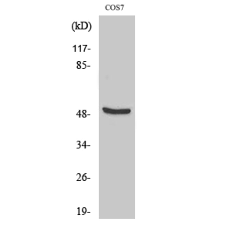 Western Blot - Anti-DP-2 Antibody (R12-2118) - Antibodies.com