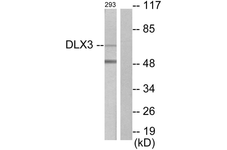 Western Blot - Anti-DLX3 Antibody (C10136) - Antibodies.com