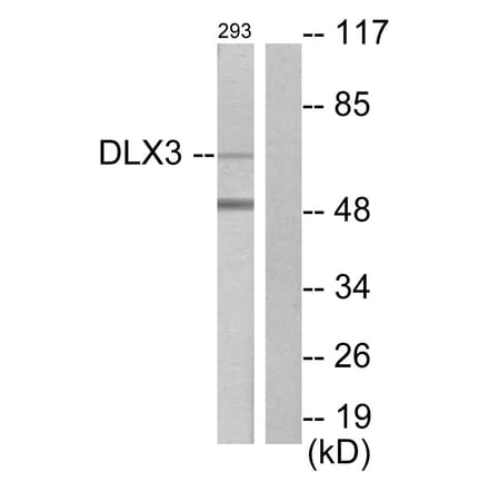 Western Blot - Anti-DLX3 Antibody (C10136) - Antibodies.com