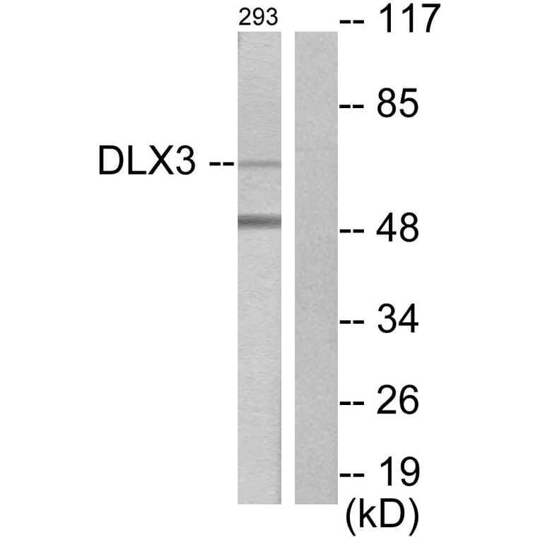Western Blot - Anti-DLX3 Antibody (C10136) - Antibodies.com