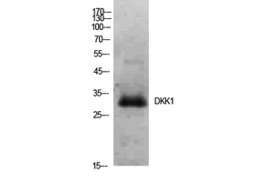 Western Blot - Anti-DKK1 Antibody (C30180) - Antibodies.com