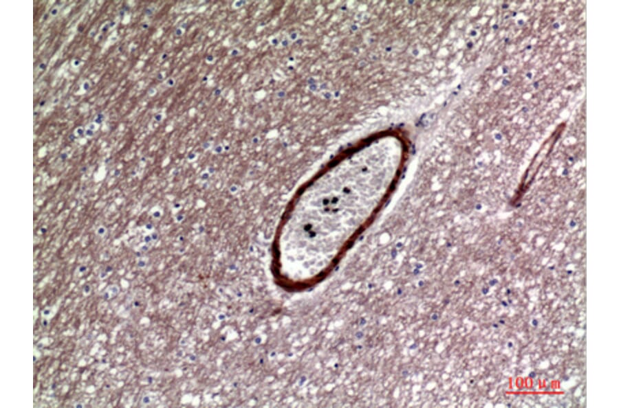 Immunohistochemistry - Anti-DKK1 Antibody (C30180) - Antibodies.com