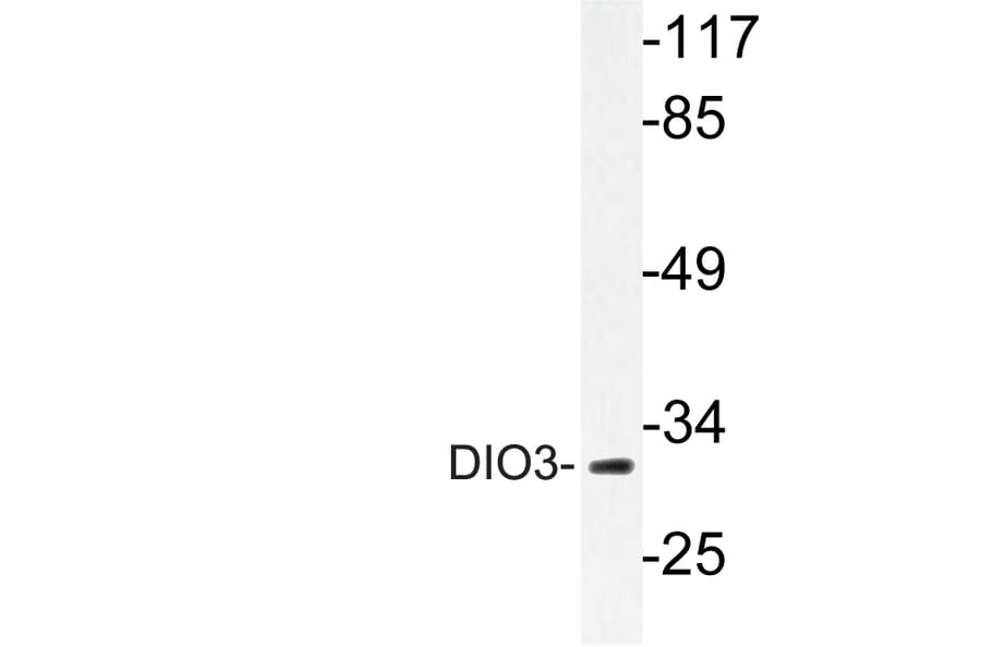 Western Blot - Anti-DIO3 Antibody (R12-2117) - Antibodies.com