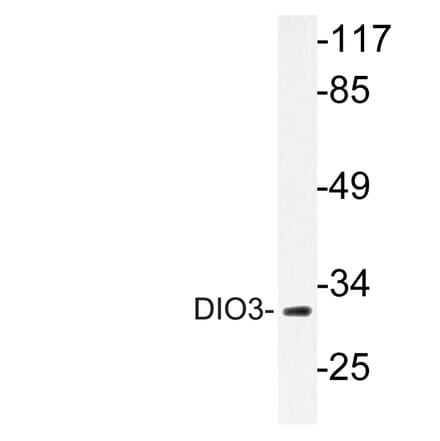 Western Blot - Anti-DIO3 Antibody (R12-2117) - Antibodies.com