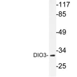 Western Blot - Anti-DIO3 Antibody (R12-2117) - Antibodies.com