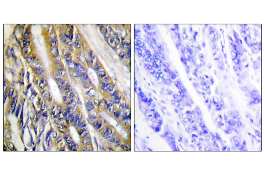 Immunohistochemistry - Anti-DGKH Antibody (C11290) - Antibodies.com