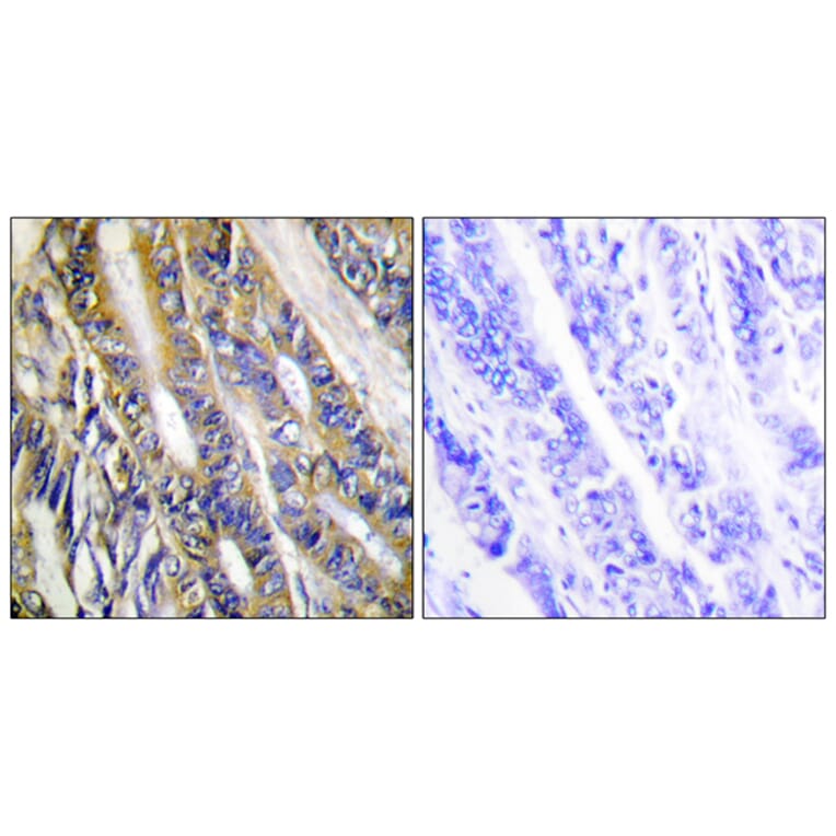 Immunohistochemistry - Anti-DGKH Antibody (C11290) - Antibodies.com