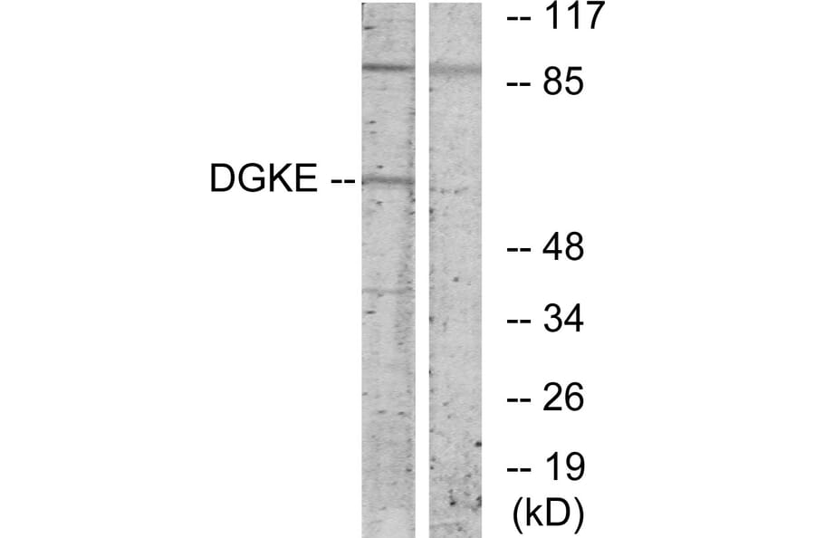 Western Blot - Anti-DGKE Antibody (C10697) - Antibodies.com