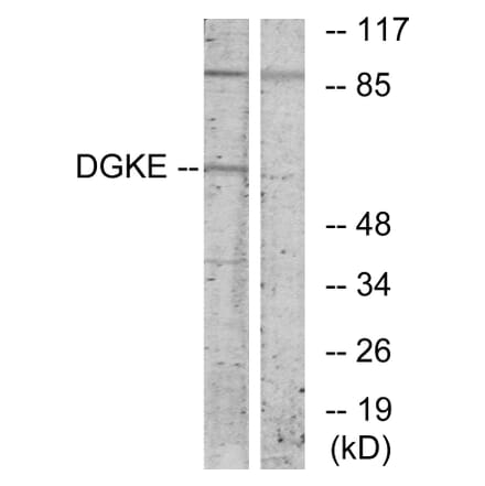Western Blot - Anti-DGKE Antibody (C10697) - Antibodies.com