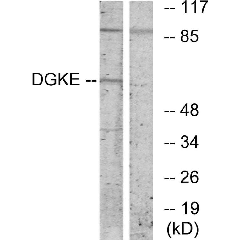 Western Blot - Anti-DGKE Antibody (C10697) - Antibodies.com