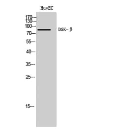 Western Blot - Anti-DGKB Antibody (C20741) - Antibodies.com