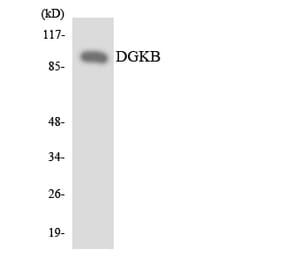 Western Blot - Anti-DGKB Antibody (R12-2694) - Antibodies.com