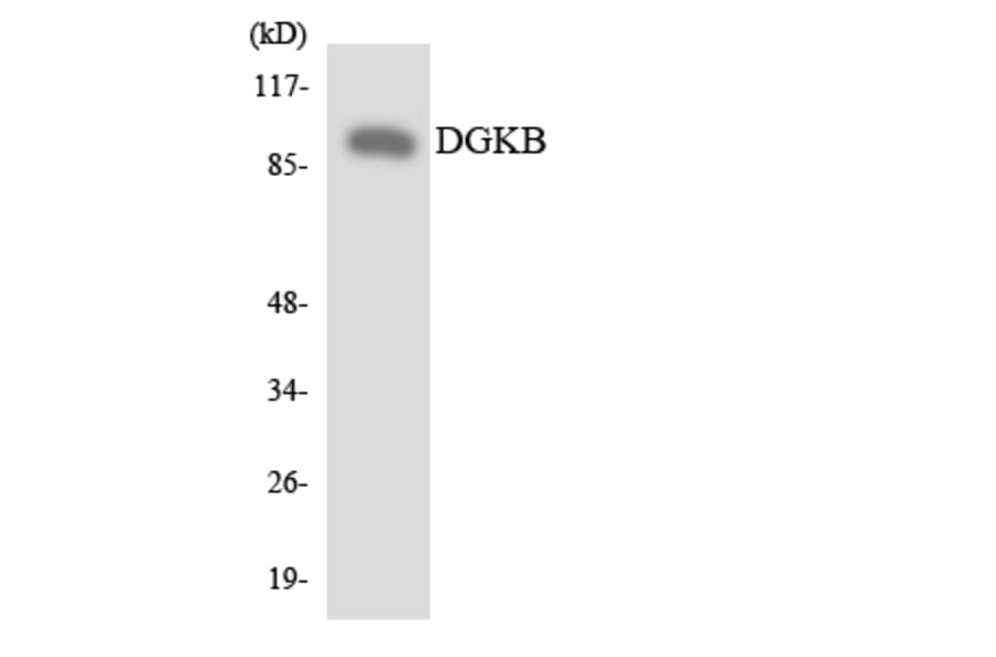 Western Blot - Anti-DGKB Antibody (R12-2694) - Antibodies.com