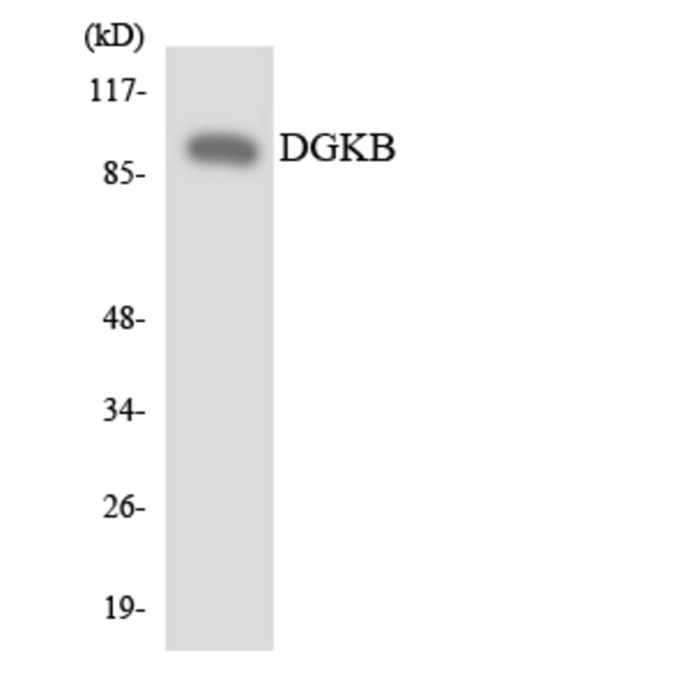 Western Blot - Anti-DGKB Antibody (R12-2694) - Antibodies.com