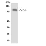 Western Blot - Anti-DGKB Antibody (R12-2694) - Antibodies.com