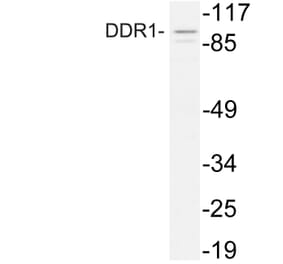 Western Blot - Anti-DDR1 Antibody (R12-2110) - Antibodies.com