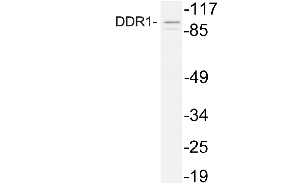 Western Blot - Anti-DDR1 Antibody (R12-2110) - Antibodies.com