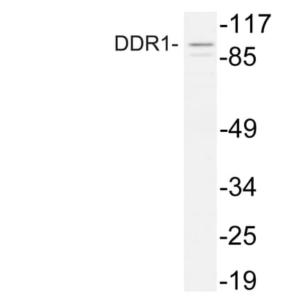 Western Blot - Anti-DDR1 Antibody (R12-2110) - Antibodies.com