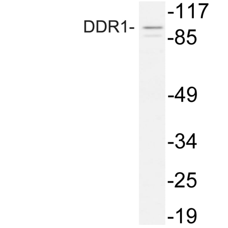 Western Blot - Anti-DDR1 Antibody (R12-2110) - Antibodies.com