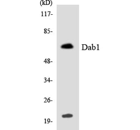 Western Blot - Anti-Dab1 Antibody (R12-2686) - Antibodies.com