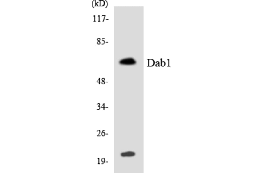 Western Blot - Anti-Dab1 Antibody (R12-2686) - Antibodies.com