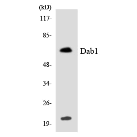 Western Blot - Anti-Dab1 Antibody (R12-2686) - Antibodies.com