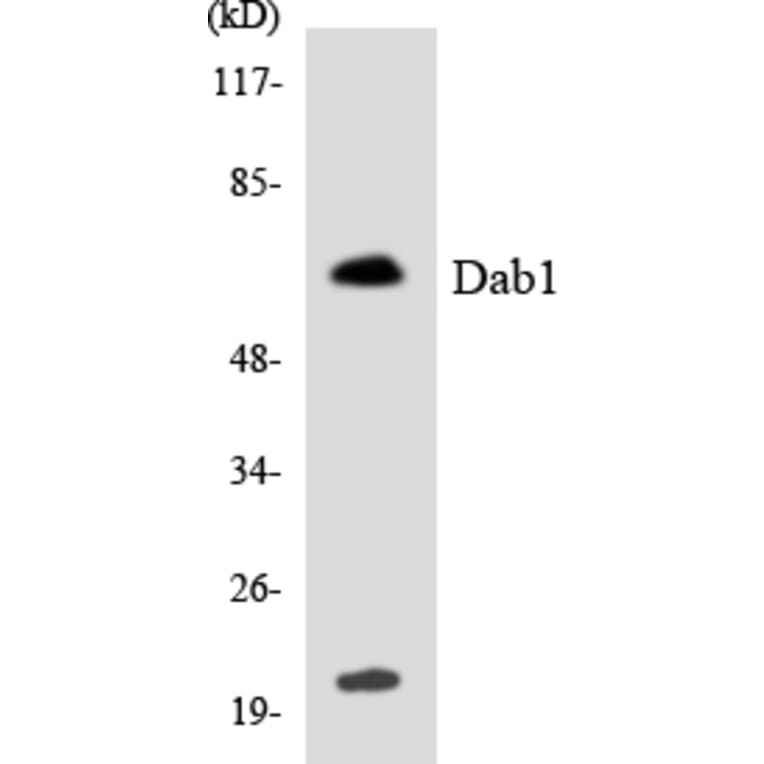 Western Blot - Anti-Dab1 Antibody (R12-2686) - Antibodies.com