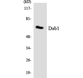 Western Blot - Anti-Dab1 Antibody (R12-2687) - Antibodies.com