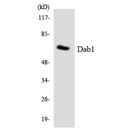 Western Blot - Anti-Dab1 Antibody (R12-2687) - Antibodies.com