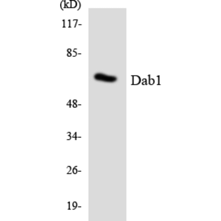 Western Blot - Anti-Dab1 Antibody (R12-2687) - Antibodies.com