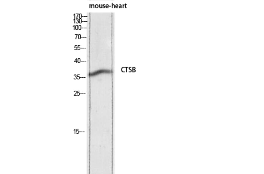 Western Blot - Anti-CTSB Antibody (C30124) - Antibodies.com