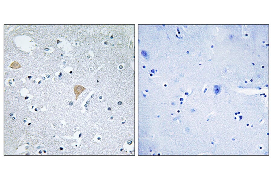 Immunohistochemistry - Anti-CTRO Antibody (C10038) - Antibodies.com
