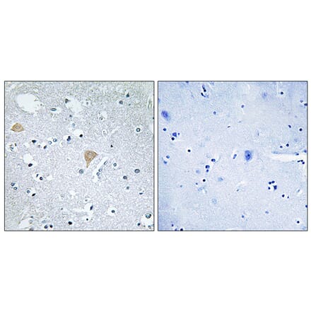 Immunohistochemistry - Anti-CTRO Antibody (C10038) - Antibodies.com