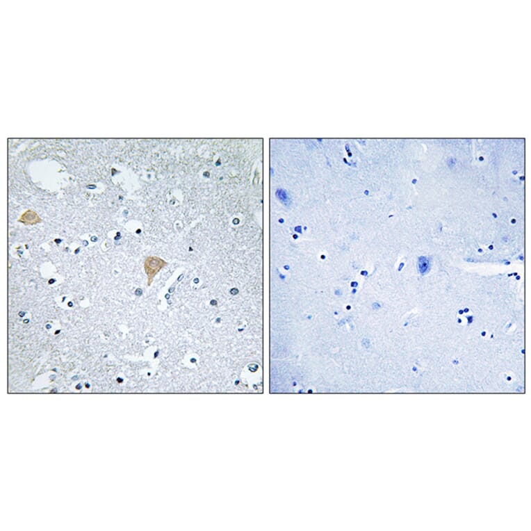 Immunohistochemistry - Anti-CTRO Antibody (C10038) - Antibodies.com