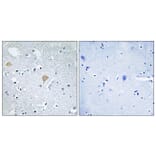 Immunohistochemistry - Anti-CTRO Antibody (C10038) - Antibodies.com