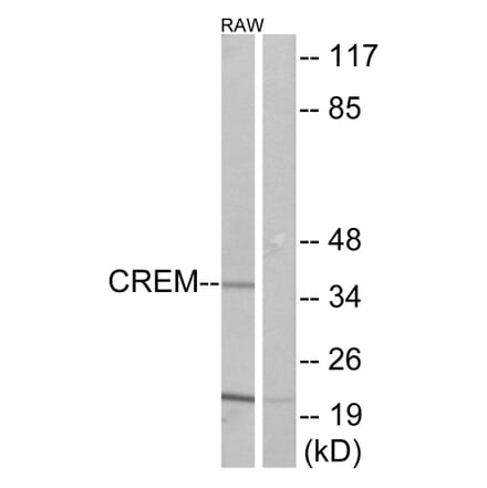 Western Blot - Anti-CREM Antibody (C10864) - Antibodies.com