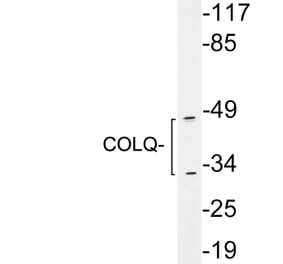 Western Blot - Anti-COLQ Antibody (R12-2097) - Antibodies.com