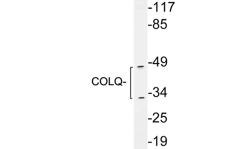 Western Blot - Anti-COLQ Antibody (R12-2097) - Antibodies.com