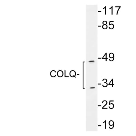 Western Blot - Anti-COLQ Antibody (R12-2097) - Antibodies.com