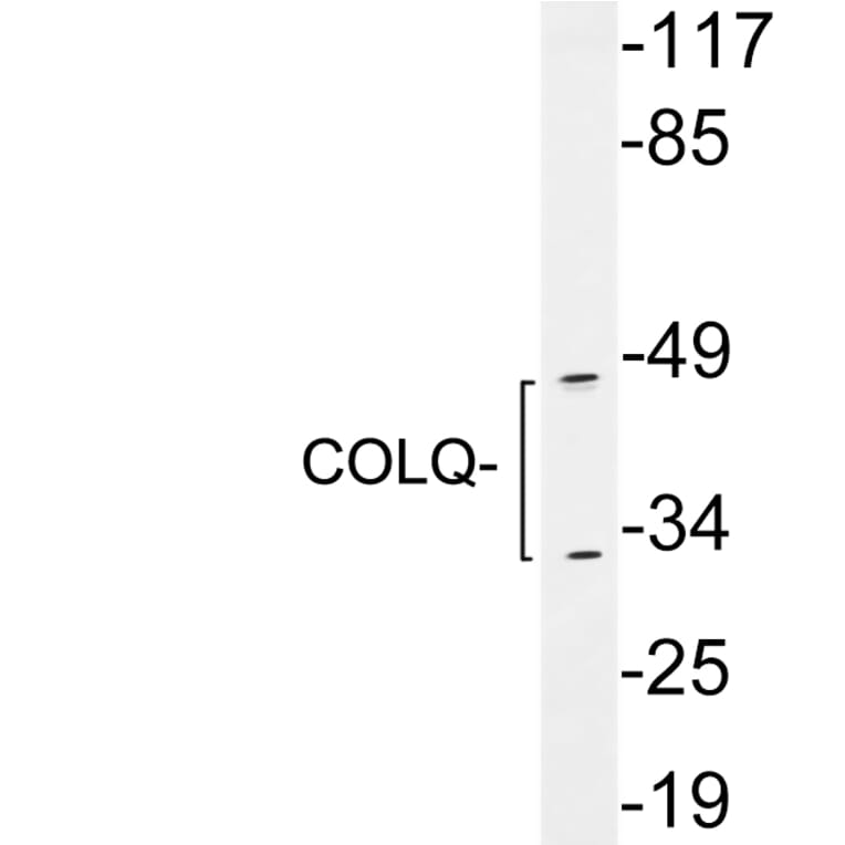 Western Blot - Anti-COLQ Antibody (R12-2097) - Antibodies.com
