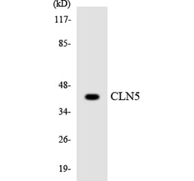 Western Blot - Anti-CLN5 Antibody (R12-2632) - Antibodies.com