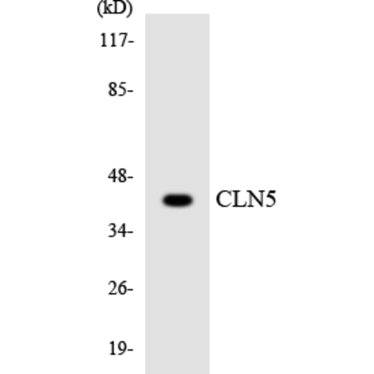 Western Blot - Anti-CLN5 Antibody (R12-2632) - Antibodies.com