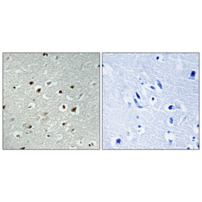 Immunohistochemistry - Anti-CLK2 Antibody (C10652) - Antibodies.com