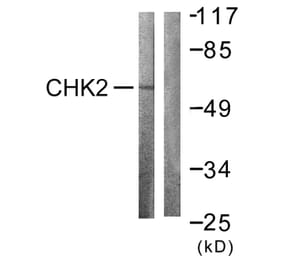 Western Blot - Anti-Chk2 Antibody (B0784) - Antibodies.com