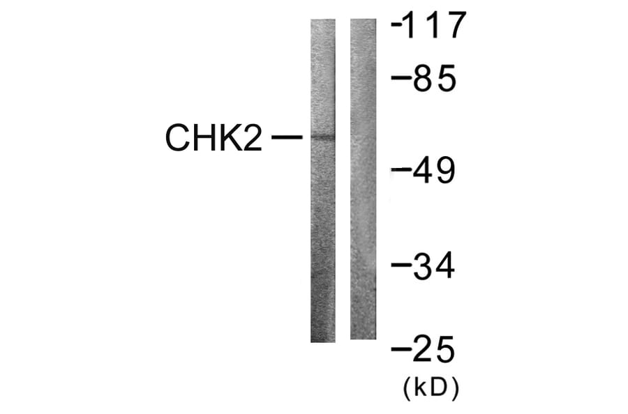 Western Blot - Anti-Chk2 Antibody (B0784) - Antibodies.com