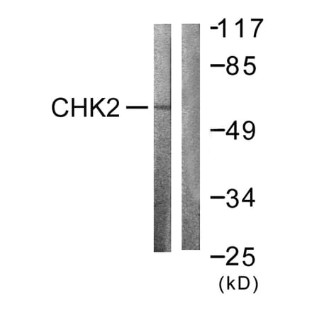 Western Blot - Anti-Chk2 Antibody (B0784) - Antibodies.com