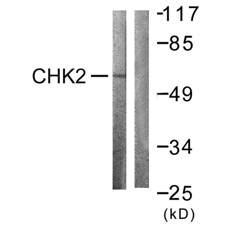 Western Blot - Anti-Chk2 Antibody (B0784) - Antibodies.com
