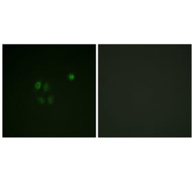 Immunofluorescence - Anti-Chk1 Antibody (B0862) - Antibodies.com